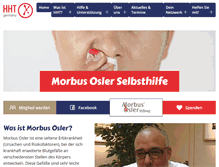 Tablet Screenshot of morbus-osler.de